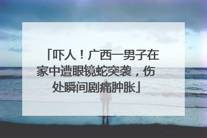 吓人！广西一男子在家中遭眼镜蛇突袭，伤处瞬间剧痛肿胀